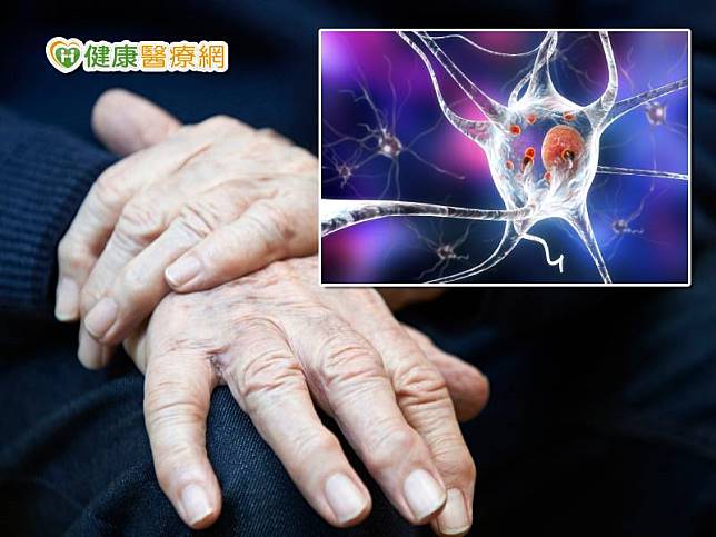 欧亿3评价,帕金森10題自我檢測